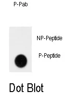 GIT1 pTyr554 Rabbit Polyclonal Antibody - image 1