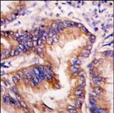 EIF2AK1 Rabbit Polyclonal Antibody - image 1