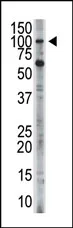 Hexokinase Type III (HK3) (C-term) Rabbit Polyclonal Antibody - image 1