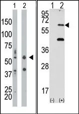 PKR (EIF2AK2) (N-term) Rabbit Polyclonal Antibody - image 1