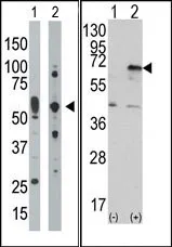 PKR (EIF2AK2) (C-term) Rabbit Polyclonal Antibody - image 1