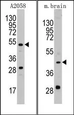 uPA (PLAU) (N-term) Rabbit Polyclonal Antibody - image 1