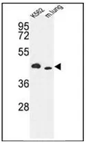 ITPKA (C-term) Rabbit Polyclonal Antibody - image 1