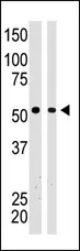 BAIAP2 (C-term) Rabbit Polyclonal Antibody - image 1