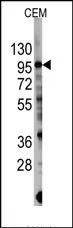 PI 3 Kinase catalytic subunit gamma (PIK3CG) Rabbit Polyclonal Antibody - image 1