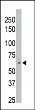 PPM1D (C-term) Rabbit Polyclonal Antibody - image 1