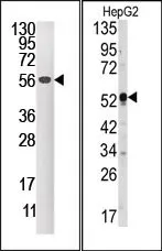 DUSP4 (C-term) Rabbit Polyclonal Antibody - image 1