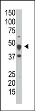 DUSP6 Rabbit Polyclonal Antibody - image 1