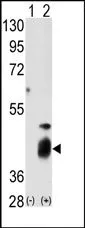 DUSP7 (N-term) Rabbit Polyclonal Antibody - image 1