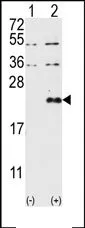 DUSP13 (N-term) Rabbit Polyclonal Antibody - image 1