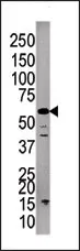 PPP3CC (C-term) Rabbit Polyclonal Antibody - image 1