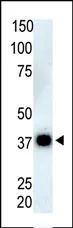 PPP6C (N-term) Rabbit Polyclonal Antibody - image 1