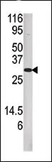DUSP3 (N-term) Rabbit Polyclonal Antibody - image 1
