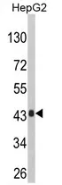 AGXT Rabbit Polyclonal Antibody - image 1