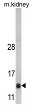 DNAJC19 Rabbit Polyclonal Antibody - image 1