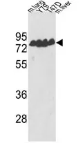 ECE1 Rabbit Polyclonal Antibody - image 1
