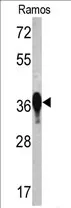 EEF1D (N-term) Rabbit Polyclonal Antibody - image 1
