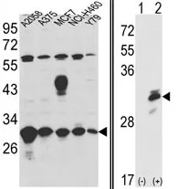 ERP29 Rabbit Polyclonal Antibody - image 1