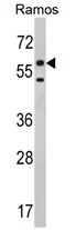 ETFDH (N-term) Rabbit Polyclonal Antibody - image 1