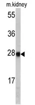 ETHE1 Rabbit Polyclonal Antibody - image 1