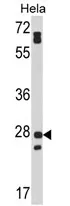 FAM3B (N-term) Rabbit Polyclonal Antibody - image 1