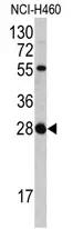 FGF18 (N-term) Rabbit Polyclonal Antibody - image 1