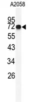 FKBP10 (C-term) Rabbit Polyclonal Antibody - image 1