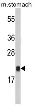 FKBP11 (N-term) Rabbit Polyclonal Antibody - image 1