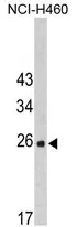 FKBP14 (N-term) Rabbit Polyclonal Antibody - image 1