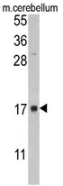 FKBP2 (N-term) Rabbit Polyclonal Antibody - image 1