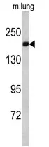 ALS2 (C-term) Rabbit Polyclonal Antibody - image 1