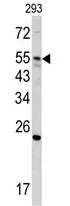 GNS Rabbit Polyclonal Antibody - image 1
