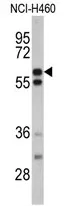 GNS Rabbit Polyclonal Antibody - image 1