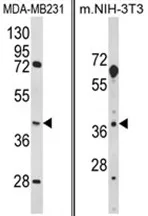 HOMER3 Rabbit Polyclonal Antibody - image 1
