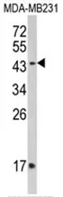 IFNGR2 (C-term) Rabbit Polyclonal Antibody - image 1