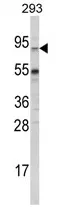 ABCG1 Rabbit Polyclonal Antibody - image 1