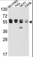 IMPDH2 Rabbit Polyclonal Antibody - image 1