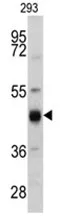 KRT13 (N-term) Rabbit Polyclonal Antibody - image 1
