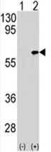 TAB1 Rabbit Polyclonal Antibody - image 1