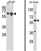 MCCC2 (Center) Rabbit Polyclonal Antibody - image 1