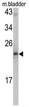 Malignant T cell amplified sequence 1 (MCTS1) (N-term) Rabbit Polyclonal Antibody - image 1