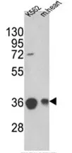 MDH2 Rabbit Polyclonal Antibody - image 1