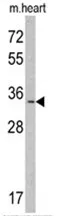 Myeloid leukemia factor 1 (MLF1) (N-term) Rabbit Polyclonal Antibody - image 1