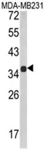 MSRB2 Rabbit Polyclonal Antibody - image 1