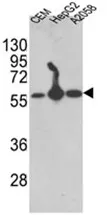 P4HB (C-term) Rabbit Polyclonal Antibody - image 1