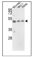PDIA6 (Center) Rabbit Polyclonal Antibody - image 1