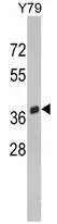 SPARC (C-term) Rabbit Polyclonal Antibody - image 1
