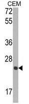 TIMP1 (N-term) Rabbit Polyclonal Antibody - image 1