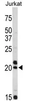 VIP (C-term) Rabbit Polyclonal Antibody - image 1