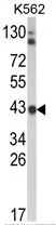 ADH5 Rabbit Polyclonal Antibody - image 1
